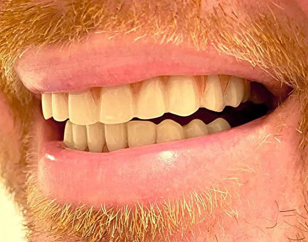 Smile Comfort Home Fix Natural Lower Your Instant at Matching Minutes! Fit Teeth Flex Shade! Smile within and Set, - Upper
